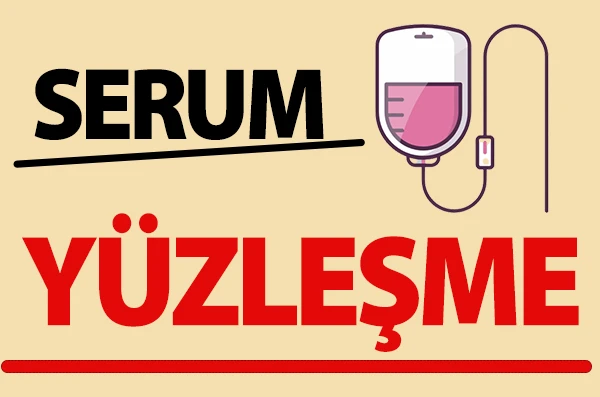 YÜZLEŞME