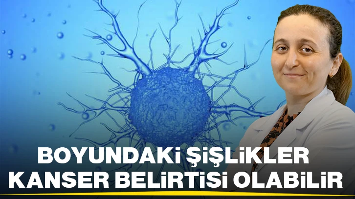 BOYUNDAKİ ŞİŞLİKLER KANSER BELİRTİSİ OLABİLİR