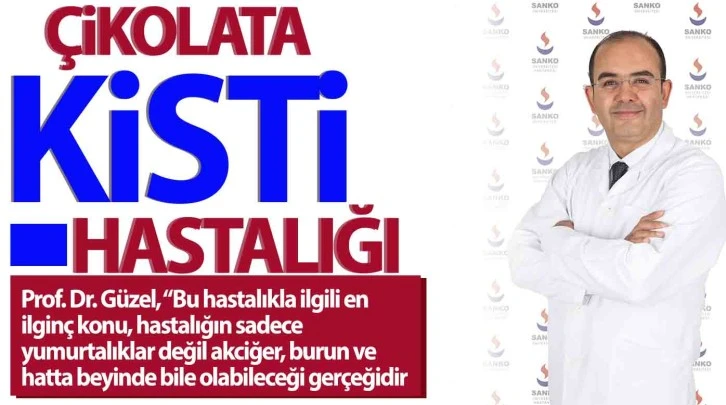 Çikolata kisti hastalığına dikkat!  