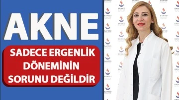 Akne Sadece Ergenlik Döneminin Sorunu Değildir  