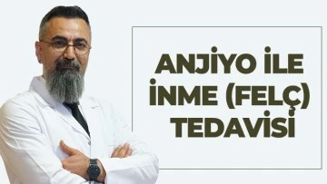 ANJİYO İLE İNME (FELÇ) TEDAVİSİ