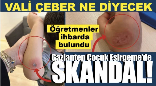 Gaziantep Çocuk Esirgeme’de SKANDAL! Öğretmenler ihbarda bulundu... VALİ ÇEBER NE DİYECEK