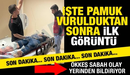 İşte Pamuk vurulduktan sonra ilk görüntü