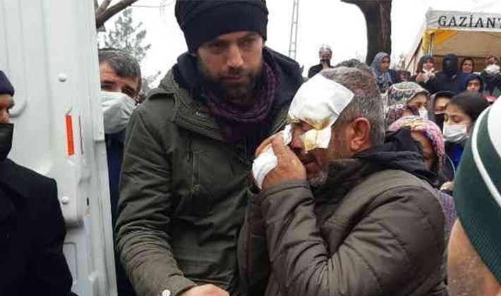 Yüzü gözü sargılar içerisinde, kazada ölen karısı için gözyaşı döktü