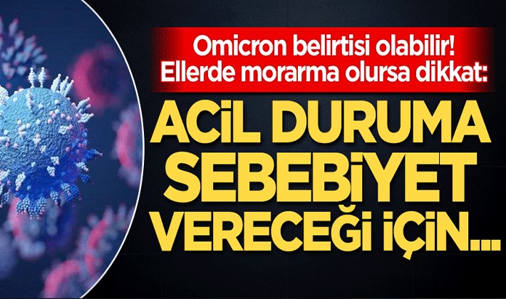 Omicron belirtisi olabilir! Ellerde morarma olursa dikkat