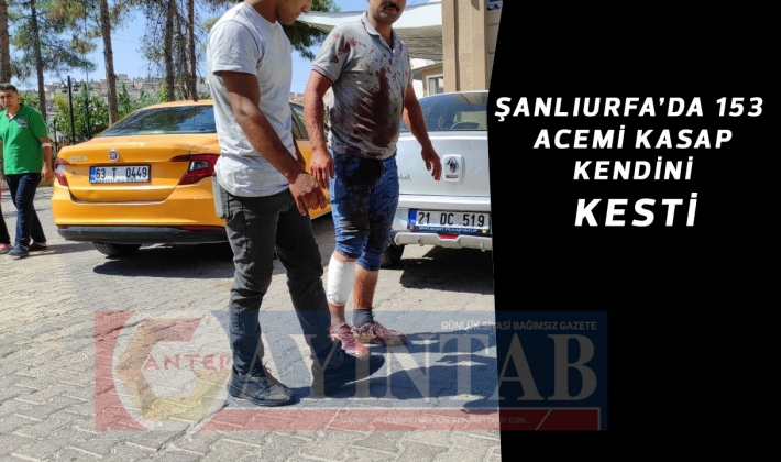 Şanlıurfa’da 153 acemi kasap kendini kesti