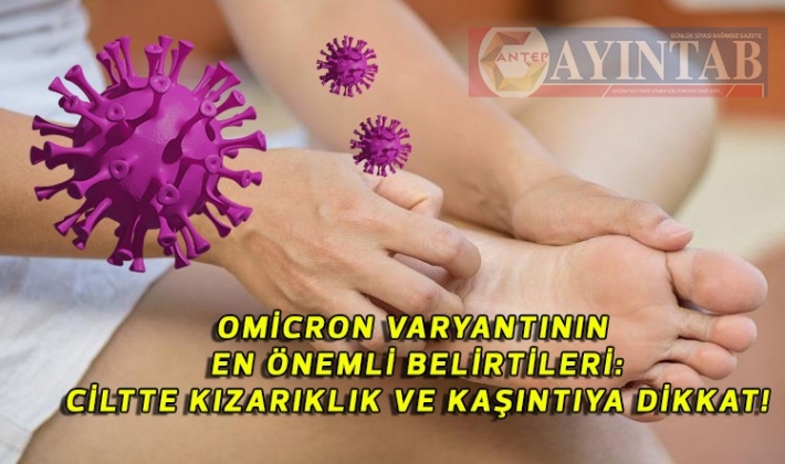 Omicron Varyantının En Önemli Belirtileri: Ciltte Kızarıklık ve Kaşıntıya Dikkat!
